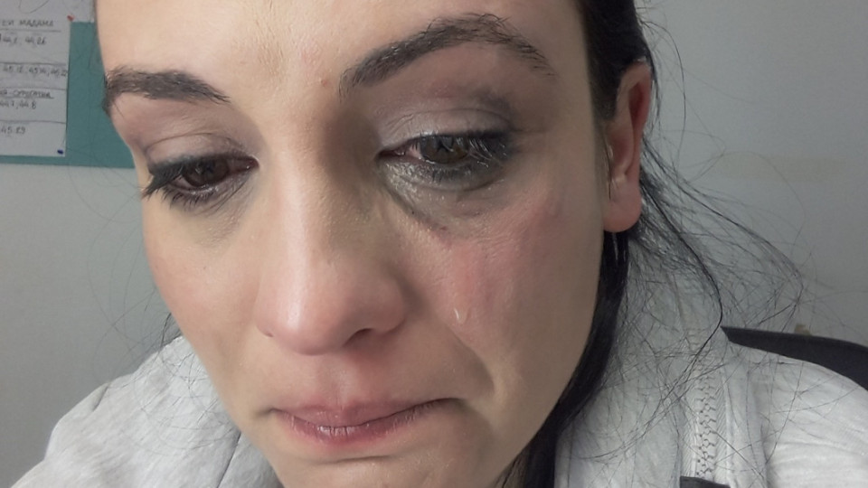 Актрисата Диана Димитрова разкри: Лицето първо ме удари в стената, после ме изрита в лицето