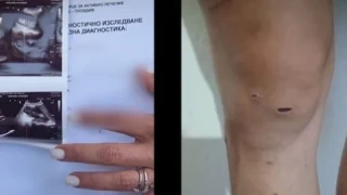Дебора 2: Дупчена с шило, стреляна и бита 3 дни се оказа с лека телесна повреда, а 27-г. й насилник Денис...