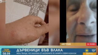 Жена получи тежка алергична реакция след нахапване от дървеници във влак на БДЖ