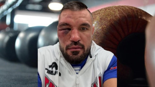 Валентинов се извини: Не съм разбрал, че отхапвам ухото на Митко
