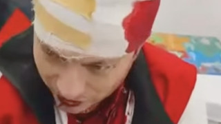 УЖАС В ГОЦЕ ДЕЛЧЕВ! Пребиха с пръти общински координатор на партия „Величие“ – откаран по спешност в болница